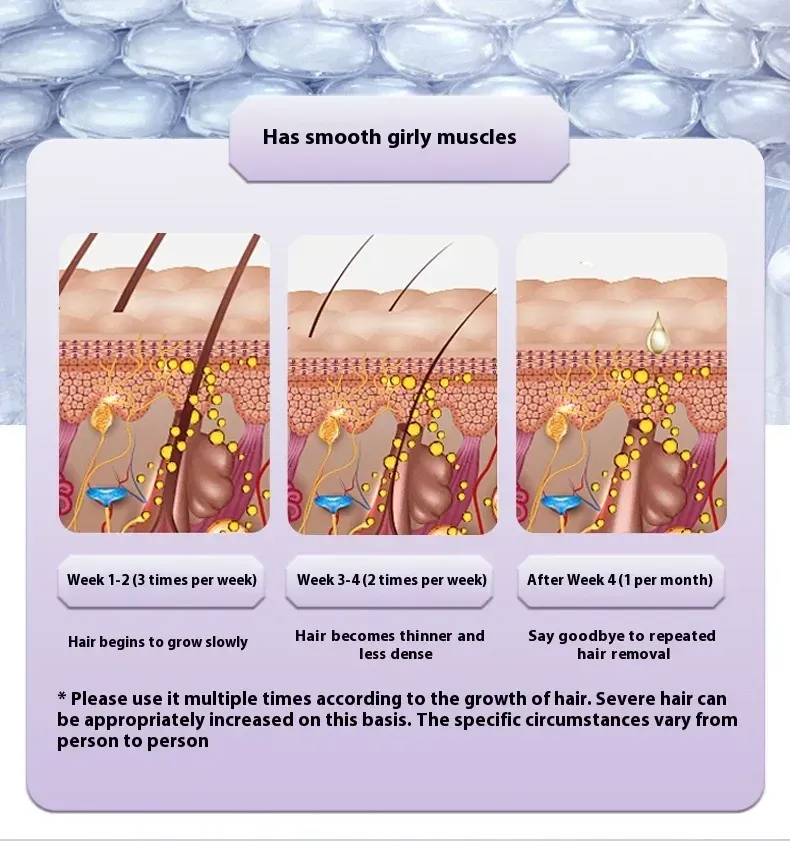 IceEpilator product 1