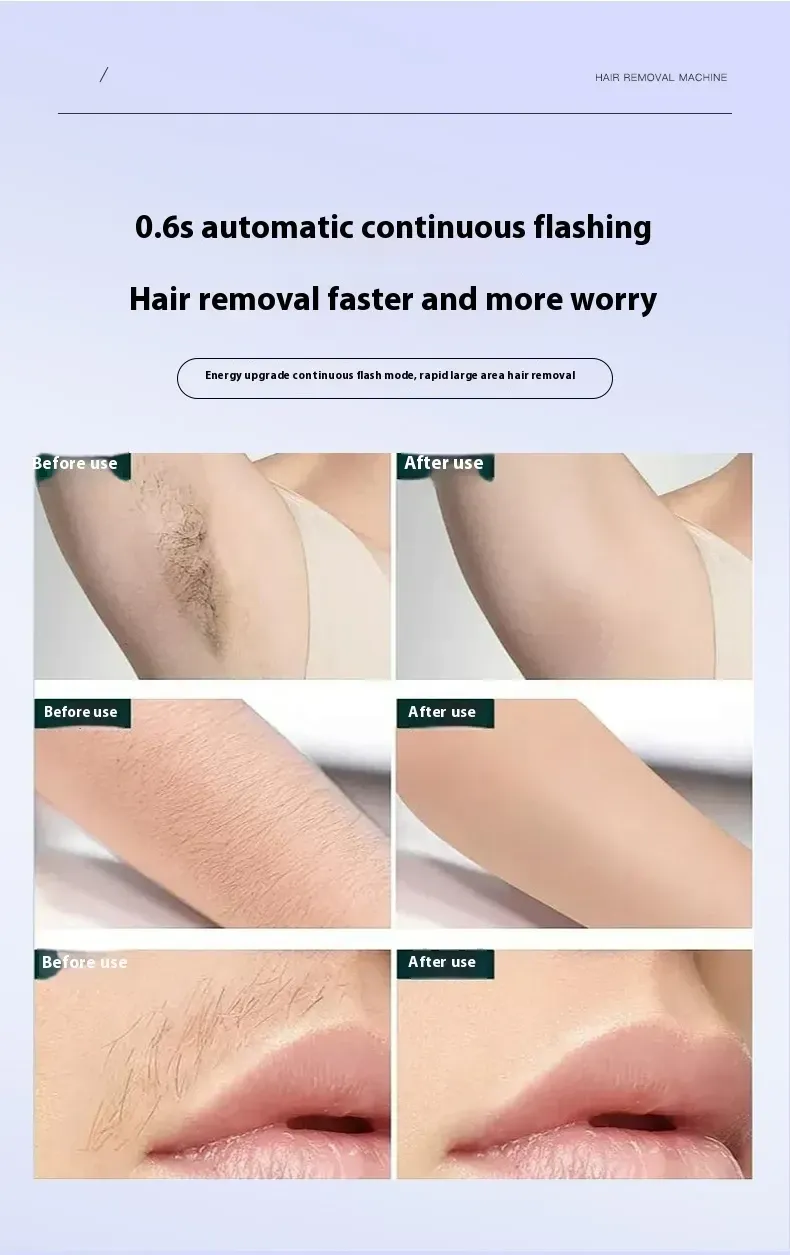 Promotional hair removal graphic showing before-and-after close-ups of underarm, arm and upper lip hair reduction with text claims about 0.6-second continuous flashing hair removal.